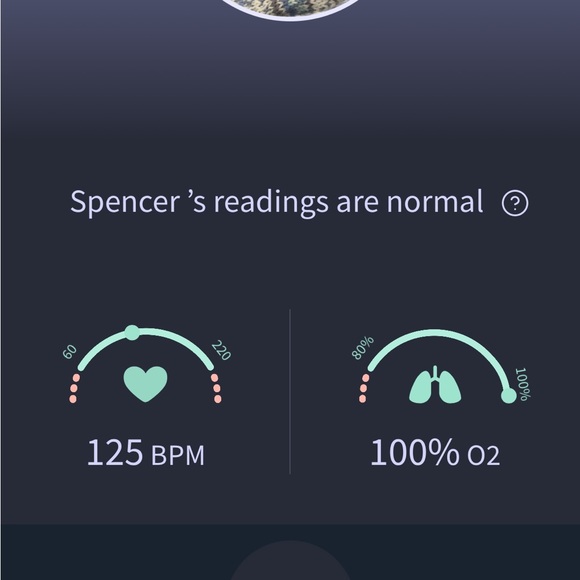 Owlet Smart Sock 3.0 - Picture 4 of 10